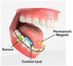 tongue-control-system